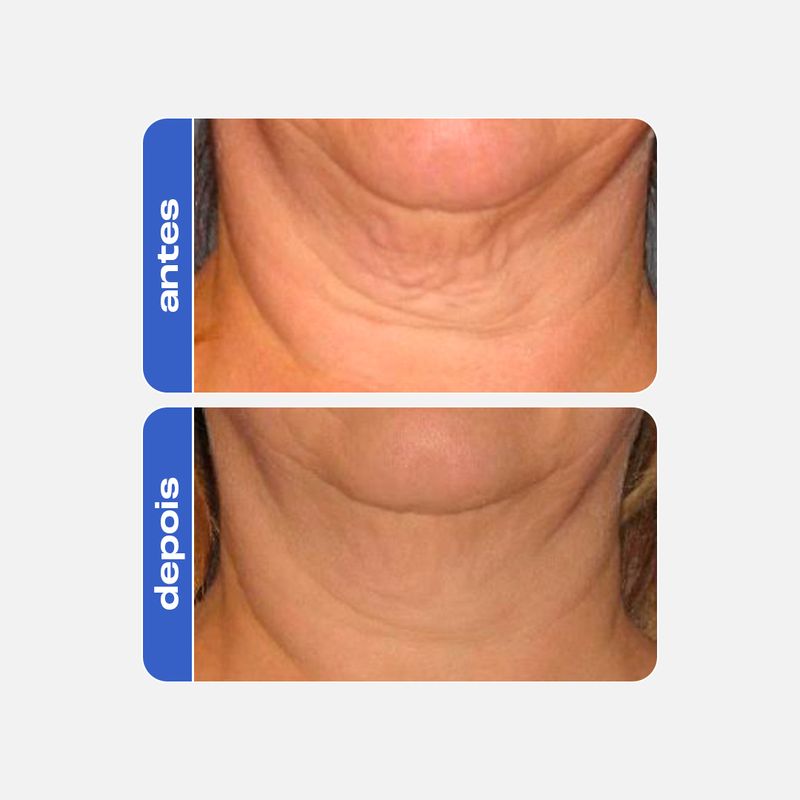 Creme Firmador Anti idade - Peptide Cream