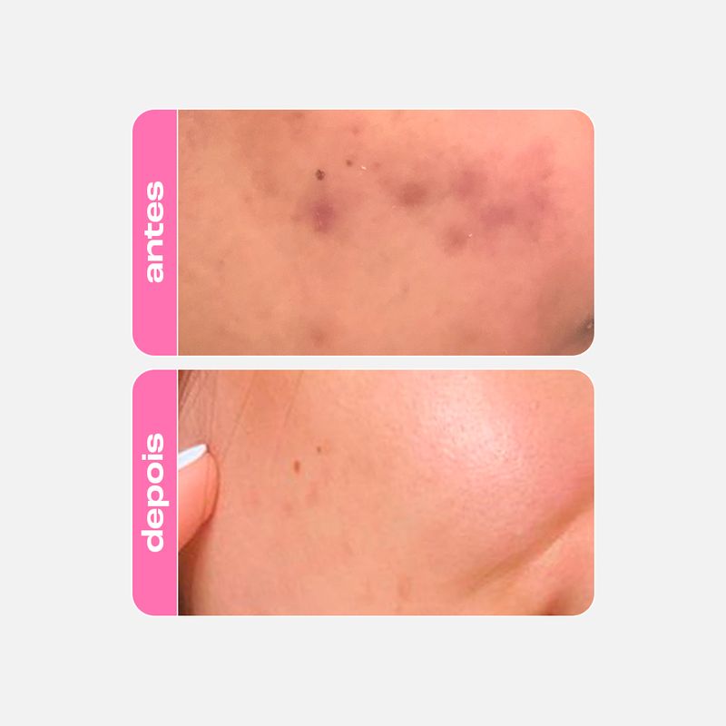 Sérum Fortalecedor Antioleosidade - Niacinamide B