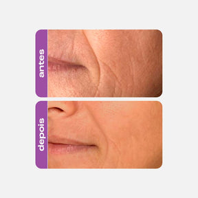 Refil Gel Creme Retinol 30g