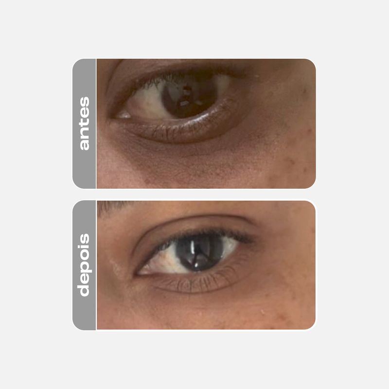 Creme Clareador para Olhos - Eye Cream
