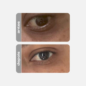 Creme Clareador para Olhos - Eye Cream