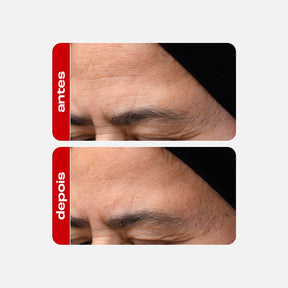 Sérum Anti idade - Retinal